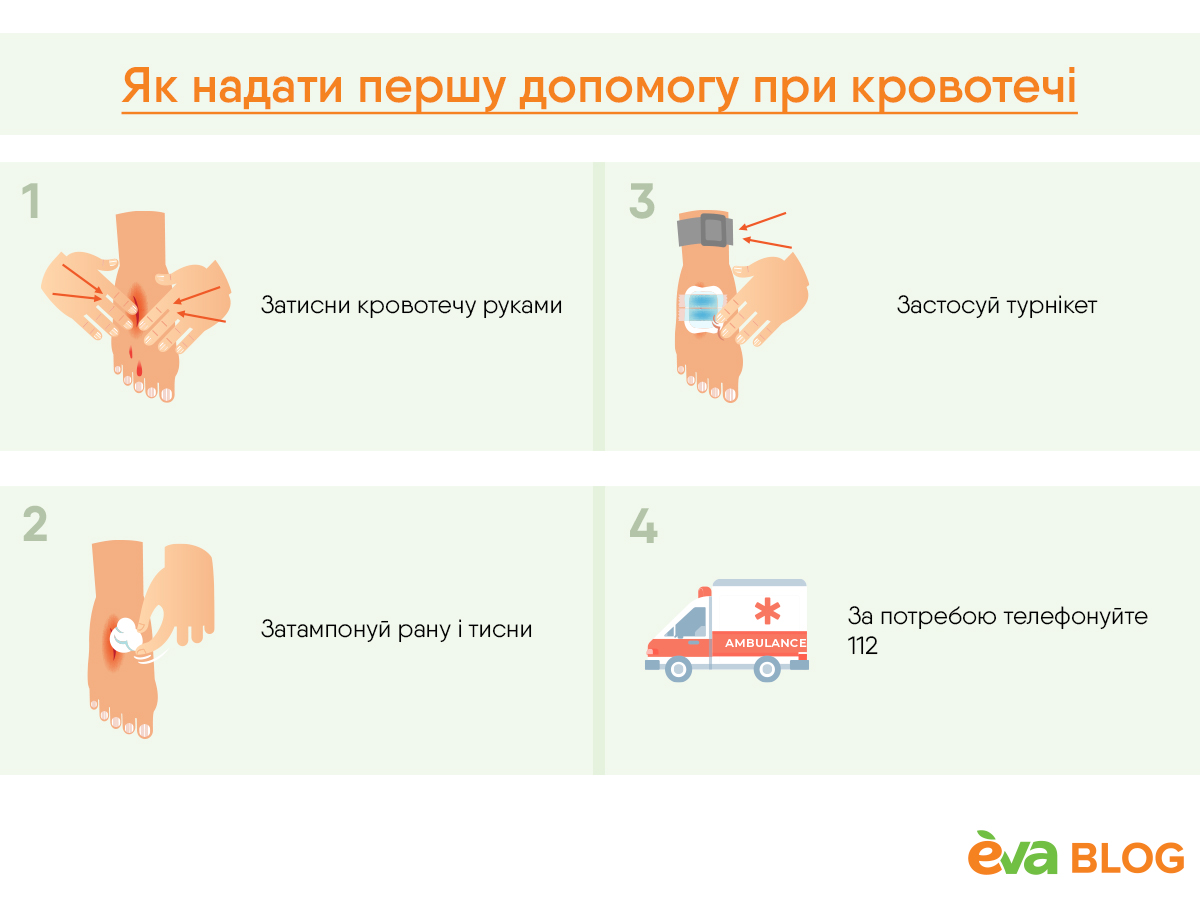 Як надати першу допомогу при: кровотечі, опіку, непритомності, пораненні » Eva Blog